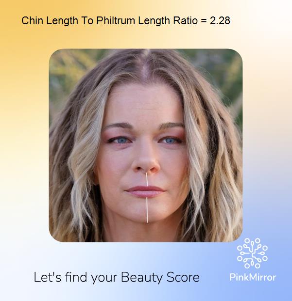 face-score-chin-length-to-philtrum-length-ratio