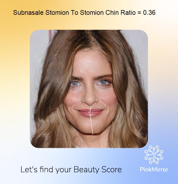 face-score-subnasale-stomion-to-stomion-chin-ratio
