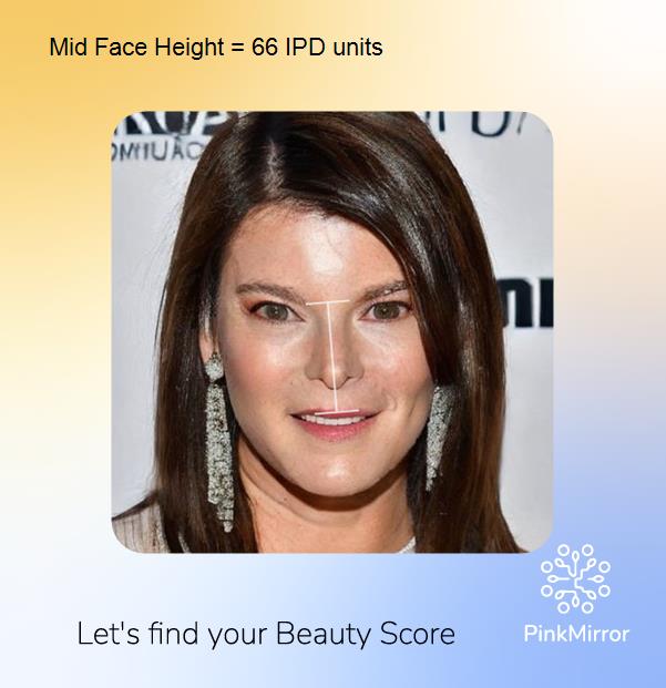 face-score-mid-face-height