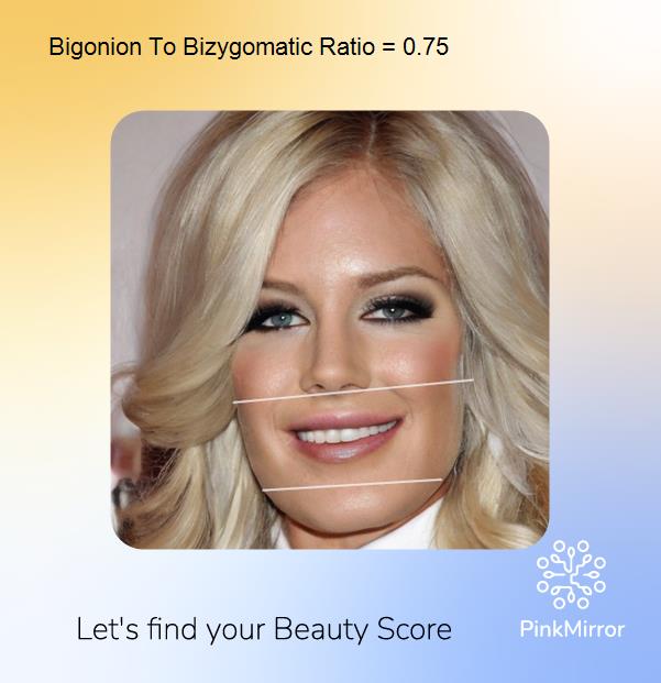 face-score-bigonion-to-bizygomatic-ratio