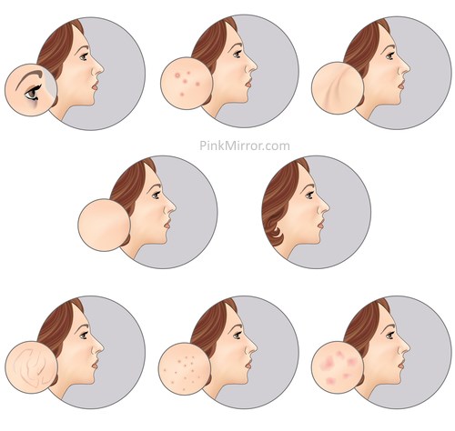 photo retouch spot wrinkle remove