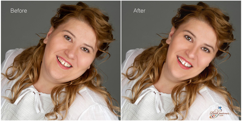 face slimming and face thinning