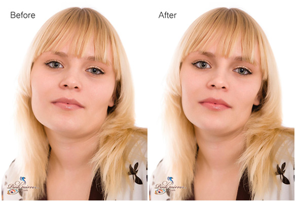 Facial Feminization Software 9