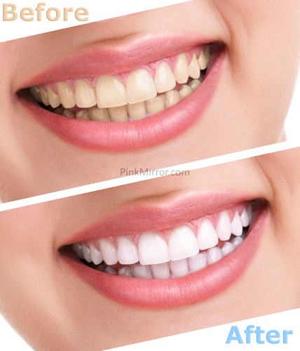 photo retouch teeth whiten