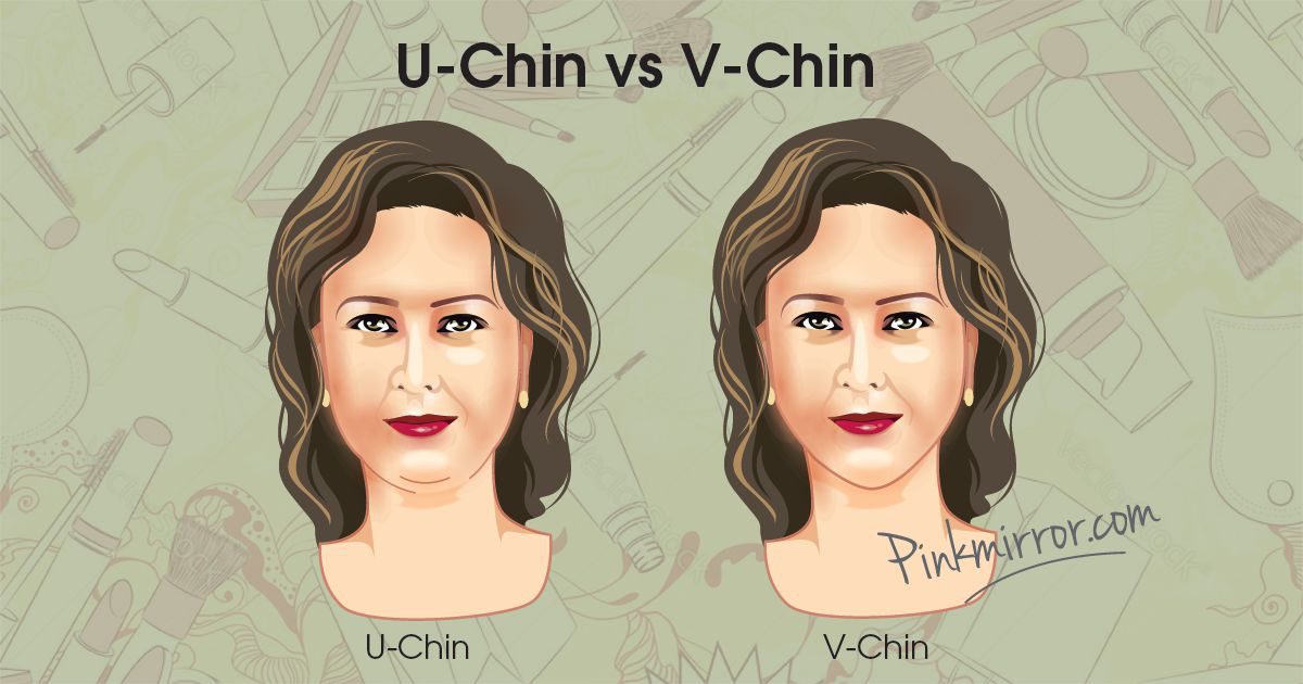 U chin vs V chin