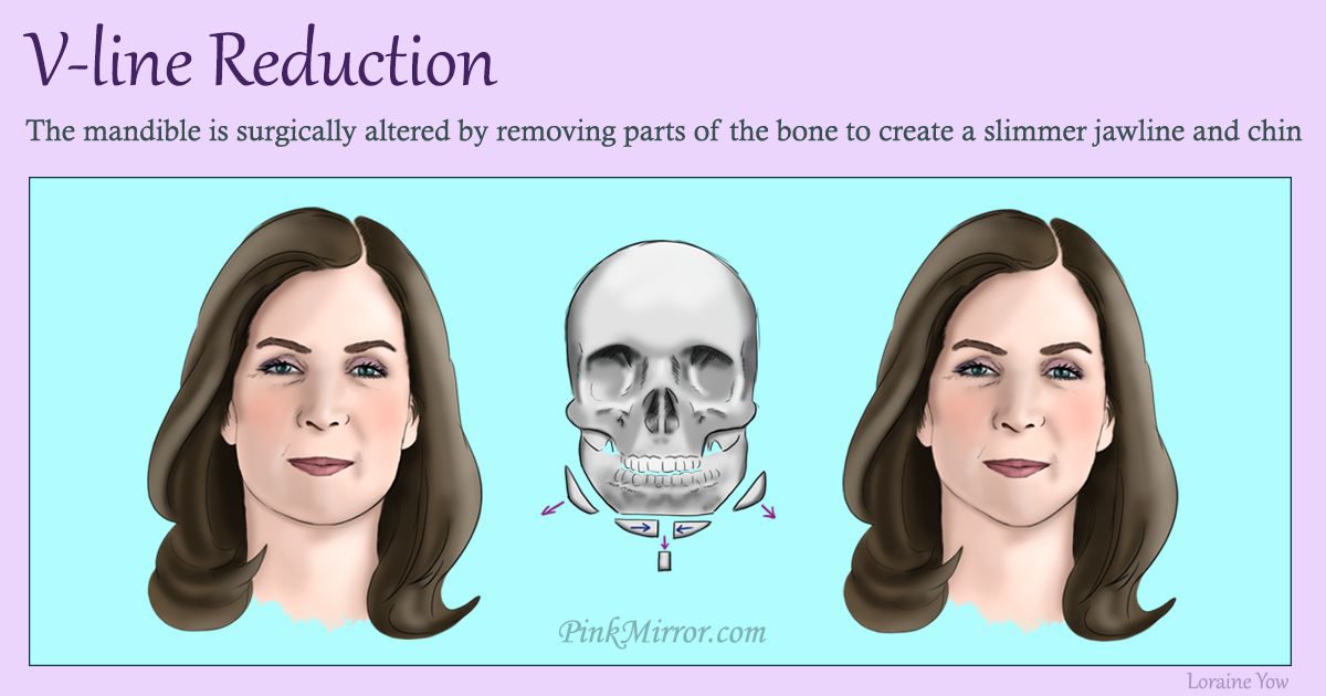 How to reduce wide face new arrivals