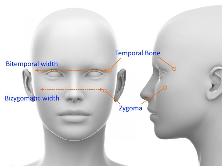 Bitemporal Vs Bizygomatic Width Pinkmirror Blog