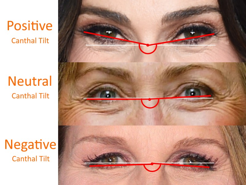 What is an Eye canthal Tilt? Why is a positive tilt more attractive than a  negative tilt among females? - PinkMirror Blog