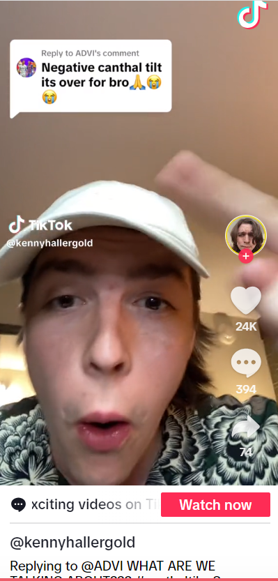 What Is Canthal Tilt and Why Is It Going Viral on TikTok?