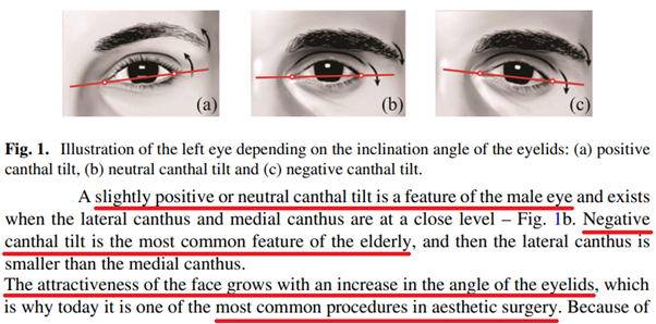 What is an Eye canthal Tilt? Why is a positive tilt more attractive than a  negative tilt among males? - PinkMirror Blog